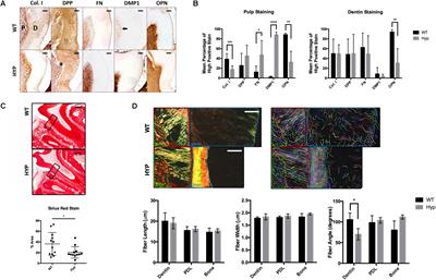 Disrupted Protein Expression and Altered Proteolytic Events in Hypophosphatemic Dentin Can Be Rescued by Dentin Matrix Protein 1